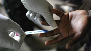 sida-premiere-cause-de-mortalite-des-10-19-ans-en-afrique